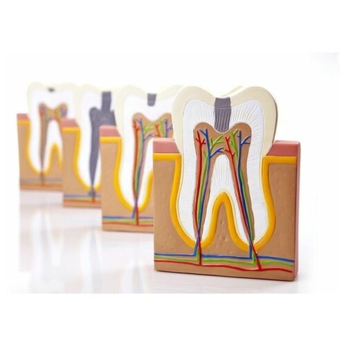      (Models of the teeth) 45. x 30. 1340